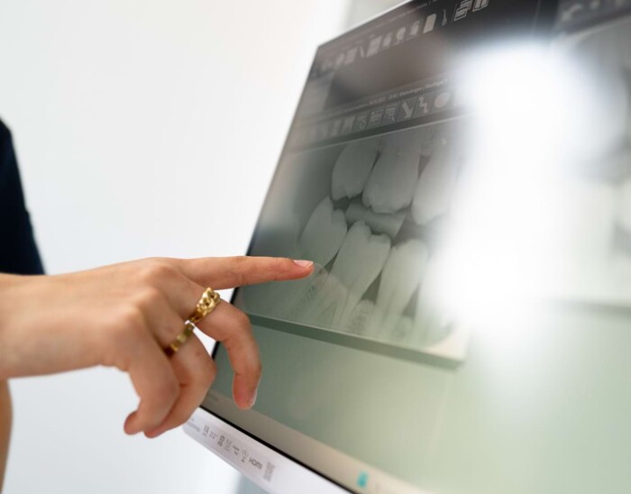 Jemand zeigt auf einen Computerscreen, der eine Aufnahme eines Kiefers zeigt.