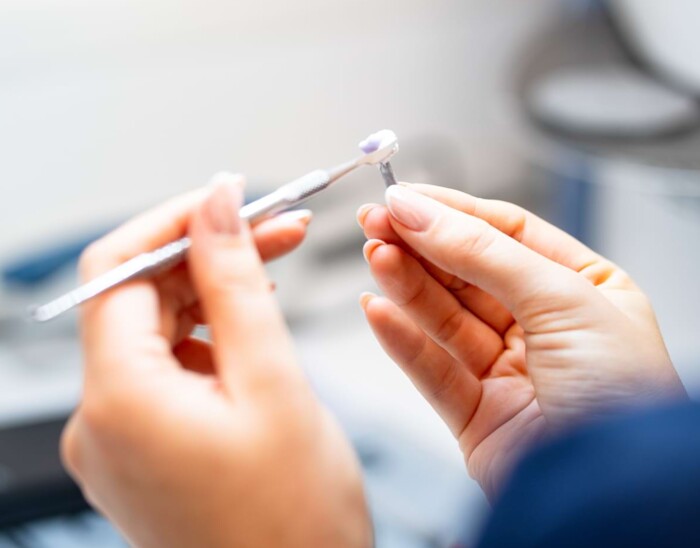 Ein Mini-Implantat wird im Labor bearbeitet.