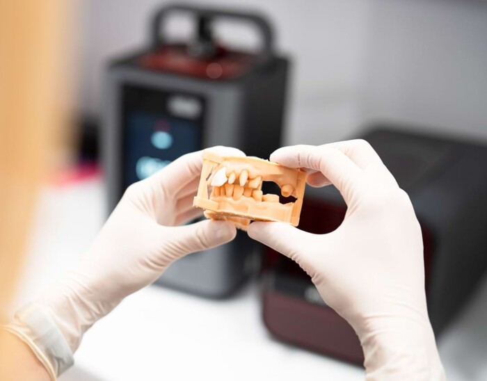 Nahaufnahme eines Zahnmodells mit Implantat darin